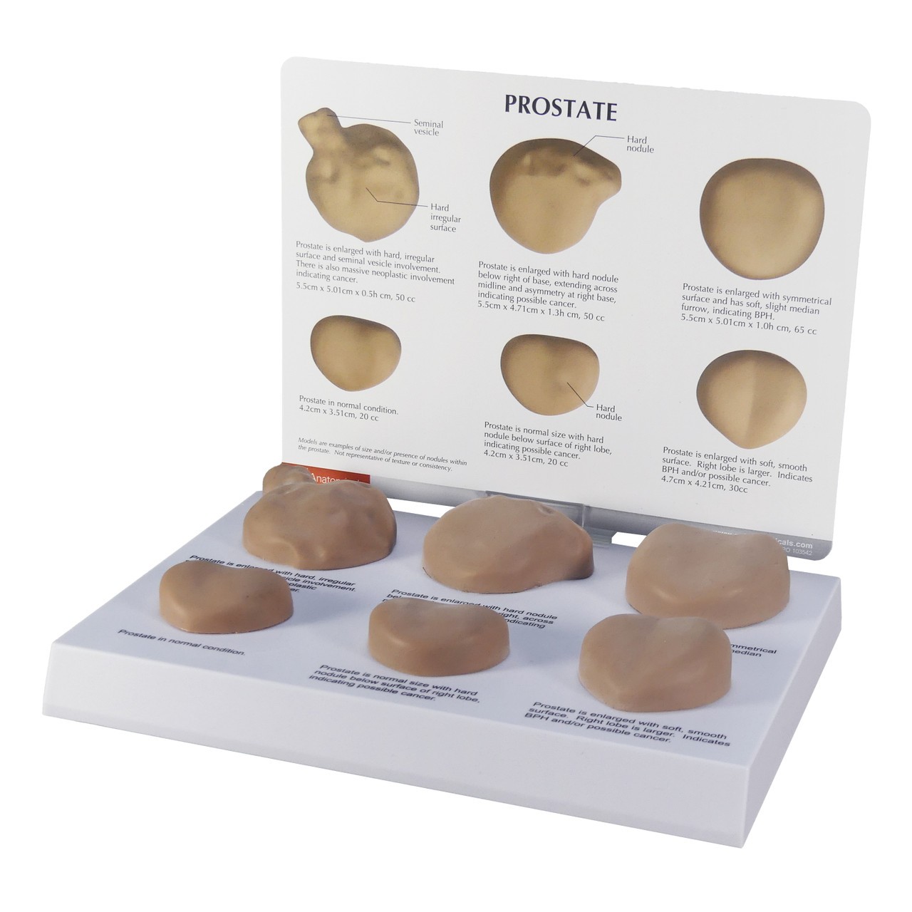 Life-Size Prostate Anatomy Model Set