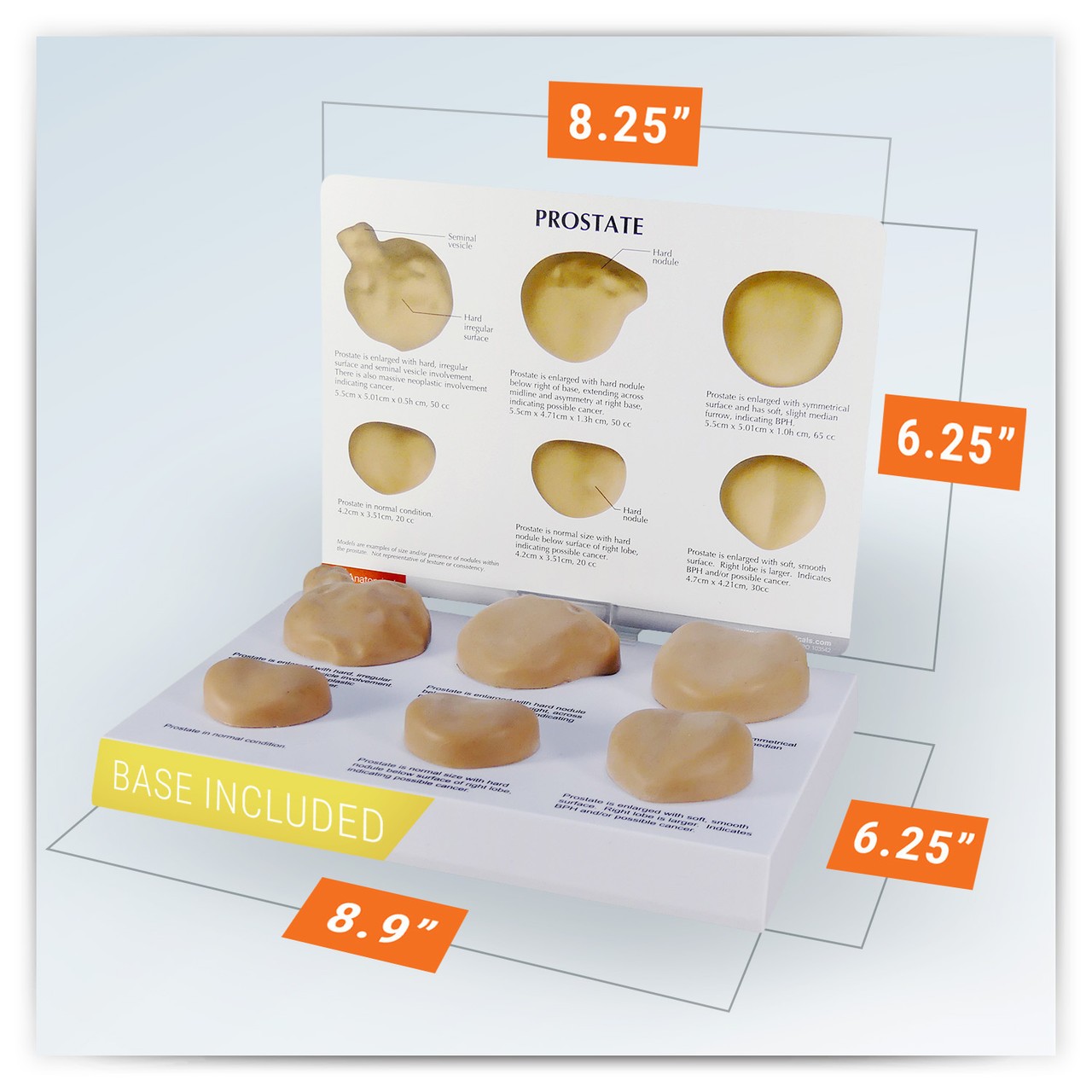 Life-Size Prostate Anatomy Model Set