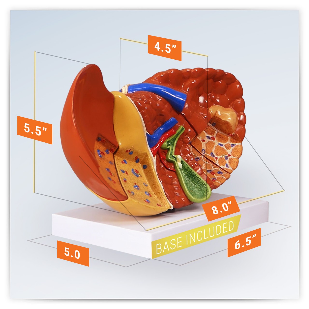 Diseased Liver Anatomy Model