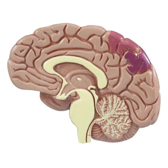 Hypertension Anatomy Model Set