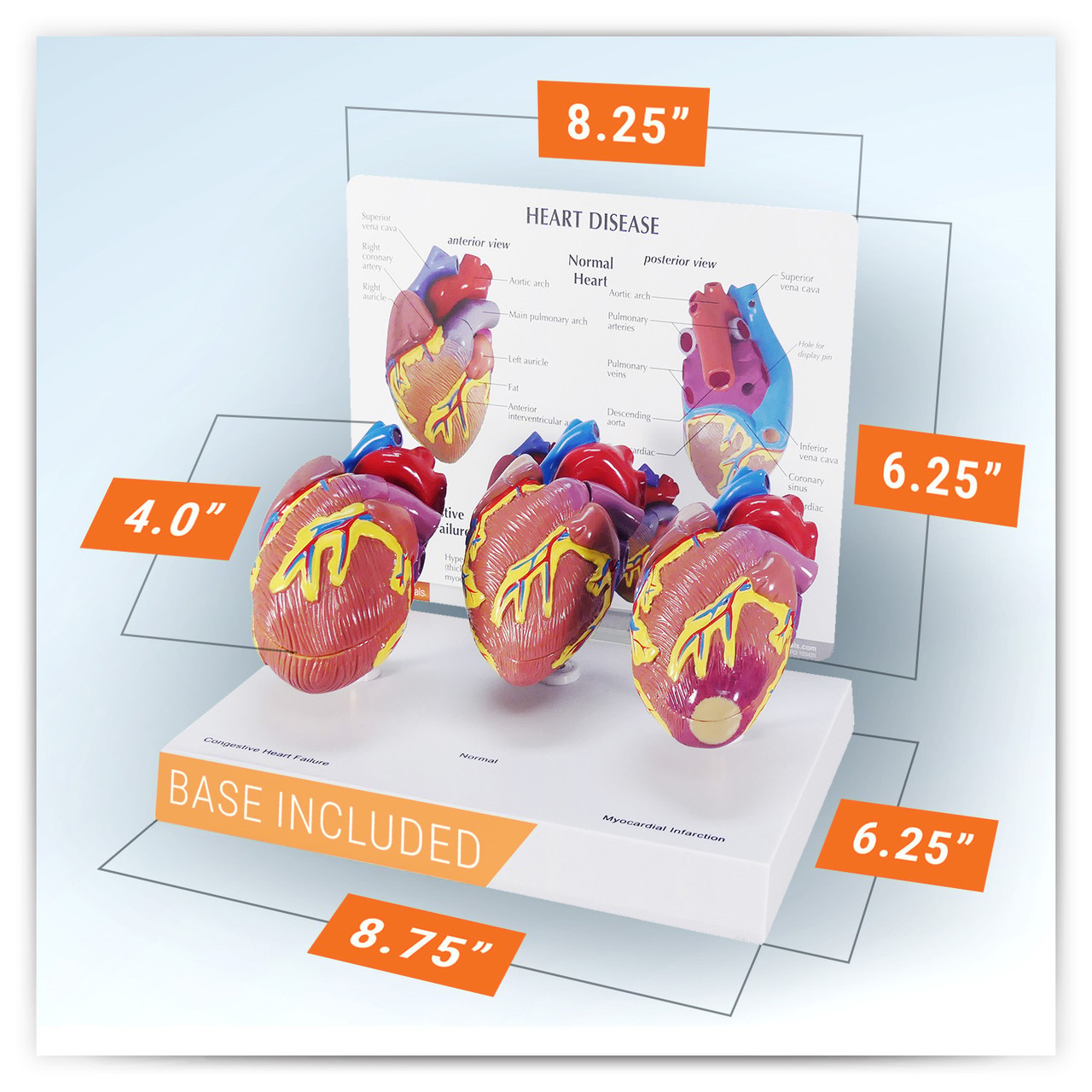3 Piece Mini Heart Anatomy Models Set