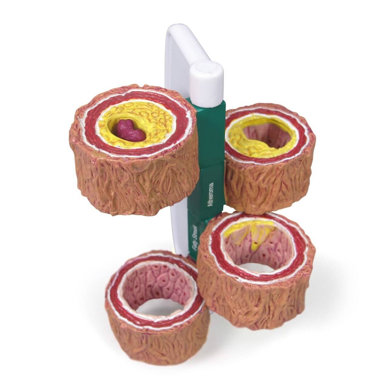 4 Piece Artery Anatomy Model