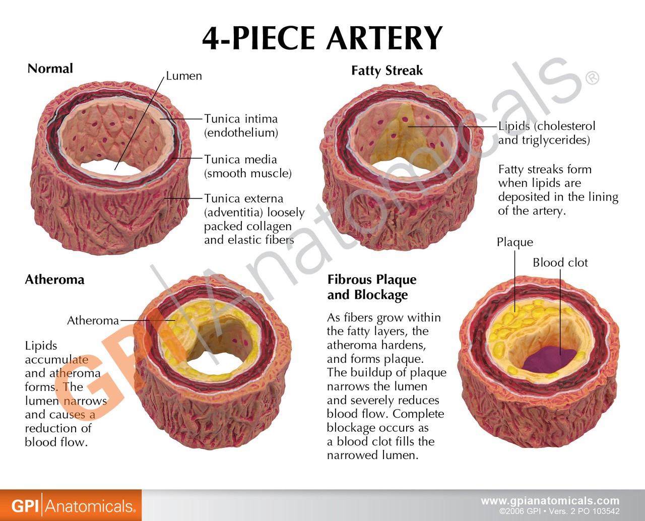 4 Piece Artery Anatomy Model