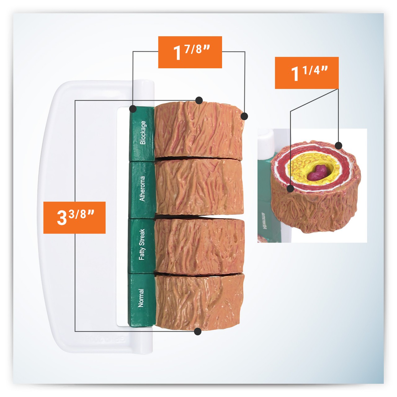 4 Piece Artery Anatomy Model