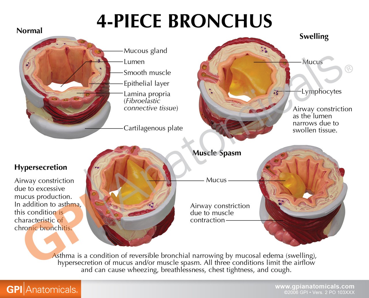 4 Piece Bronchus Anatomy Model