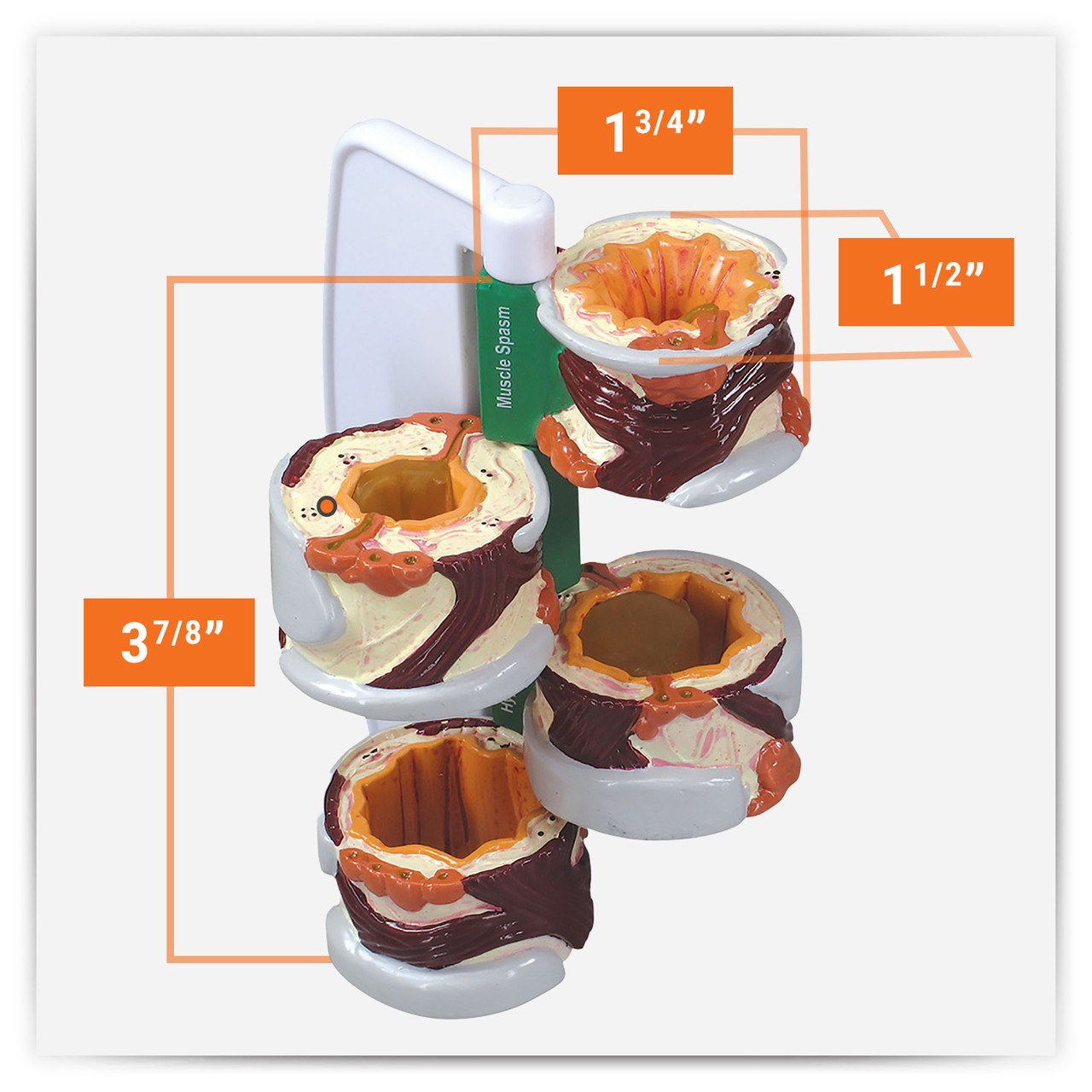 4 Piece Bronchus Anatomy Model