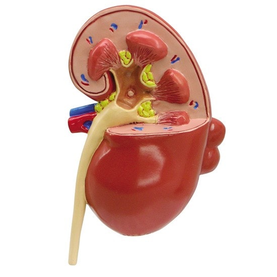 Diseased Kidney Anatomy Model