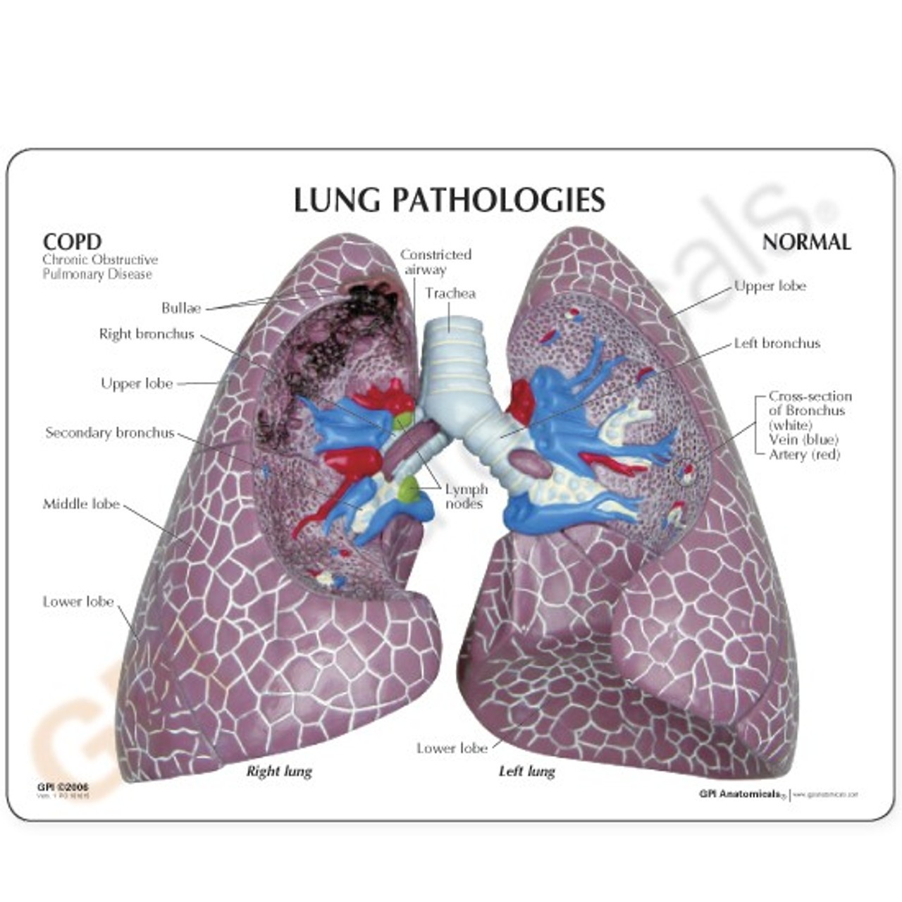 Healthy lung anatomy key card