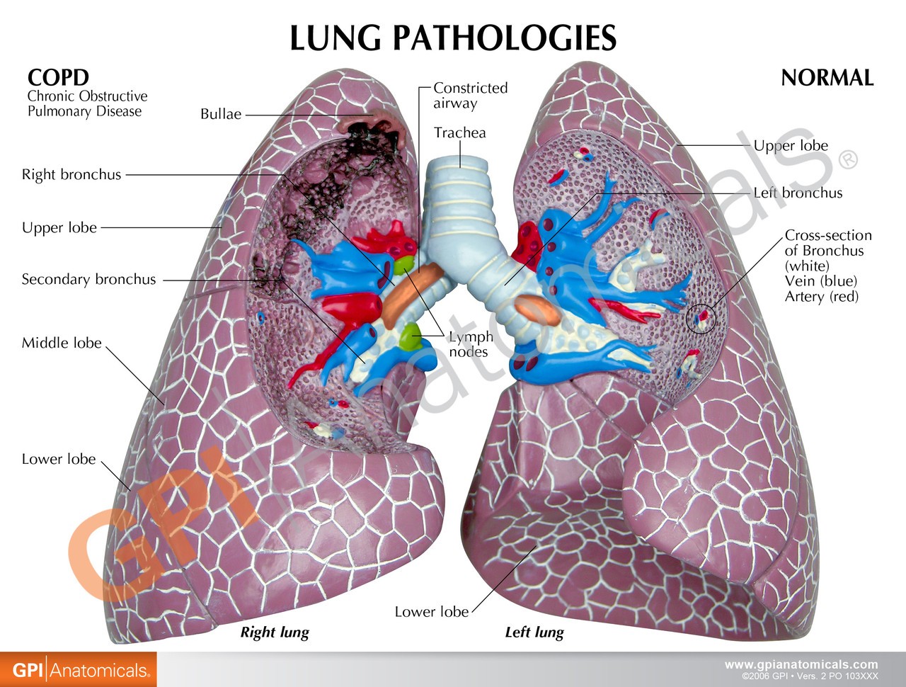 Healthy lung anatomy education card