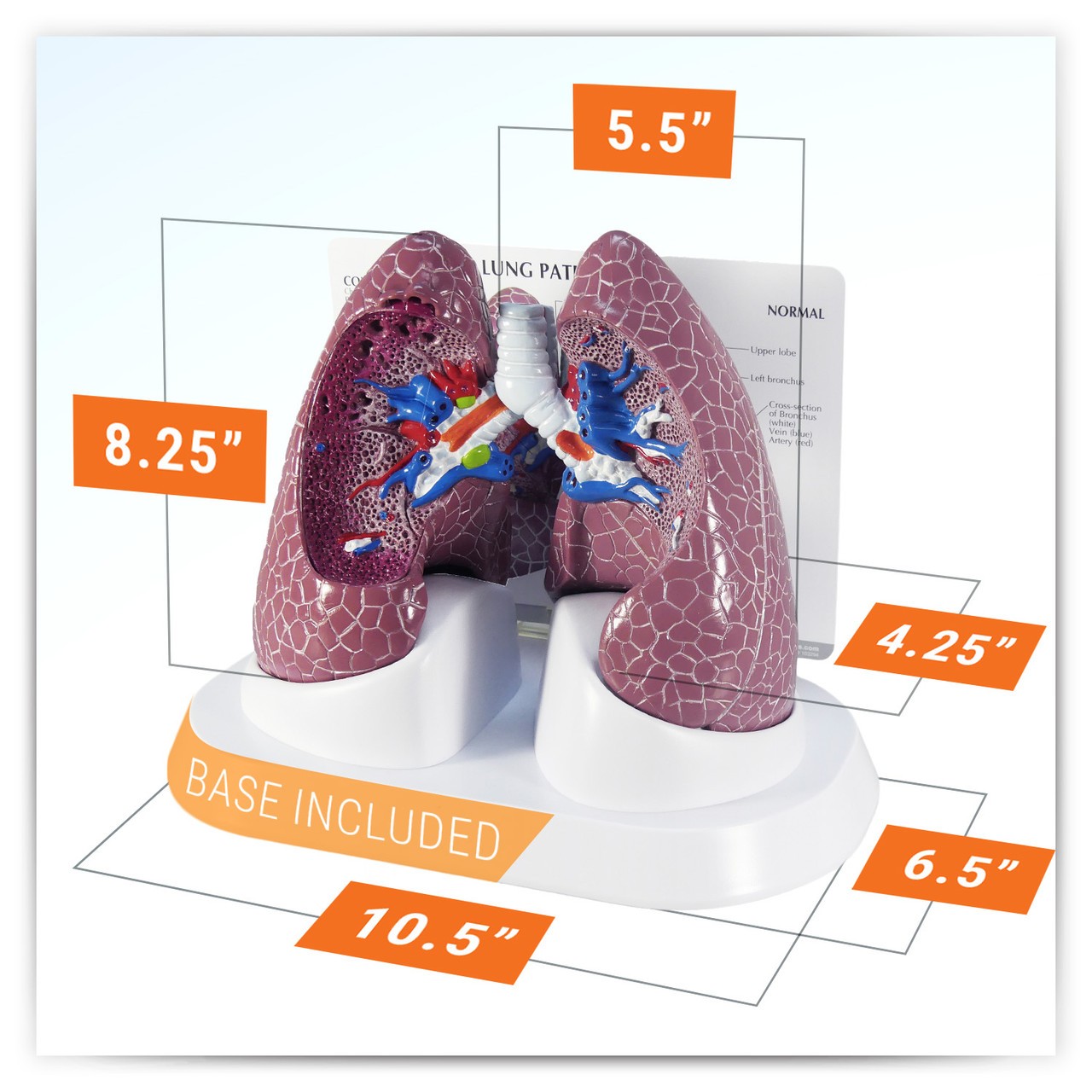 Diseased Lung Anatomy Model