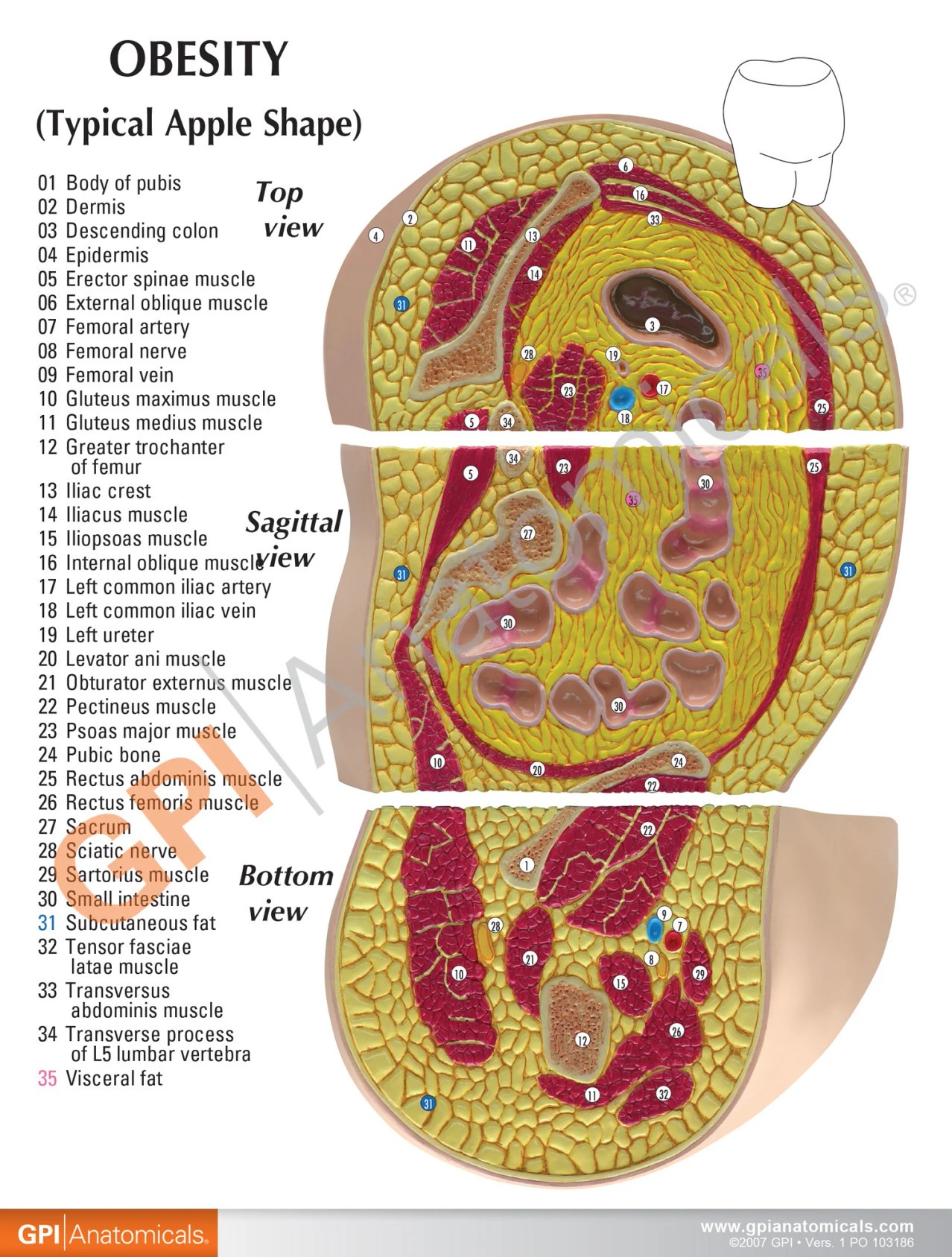 Obesity Anatomy Model