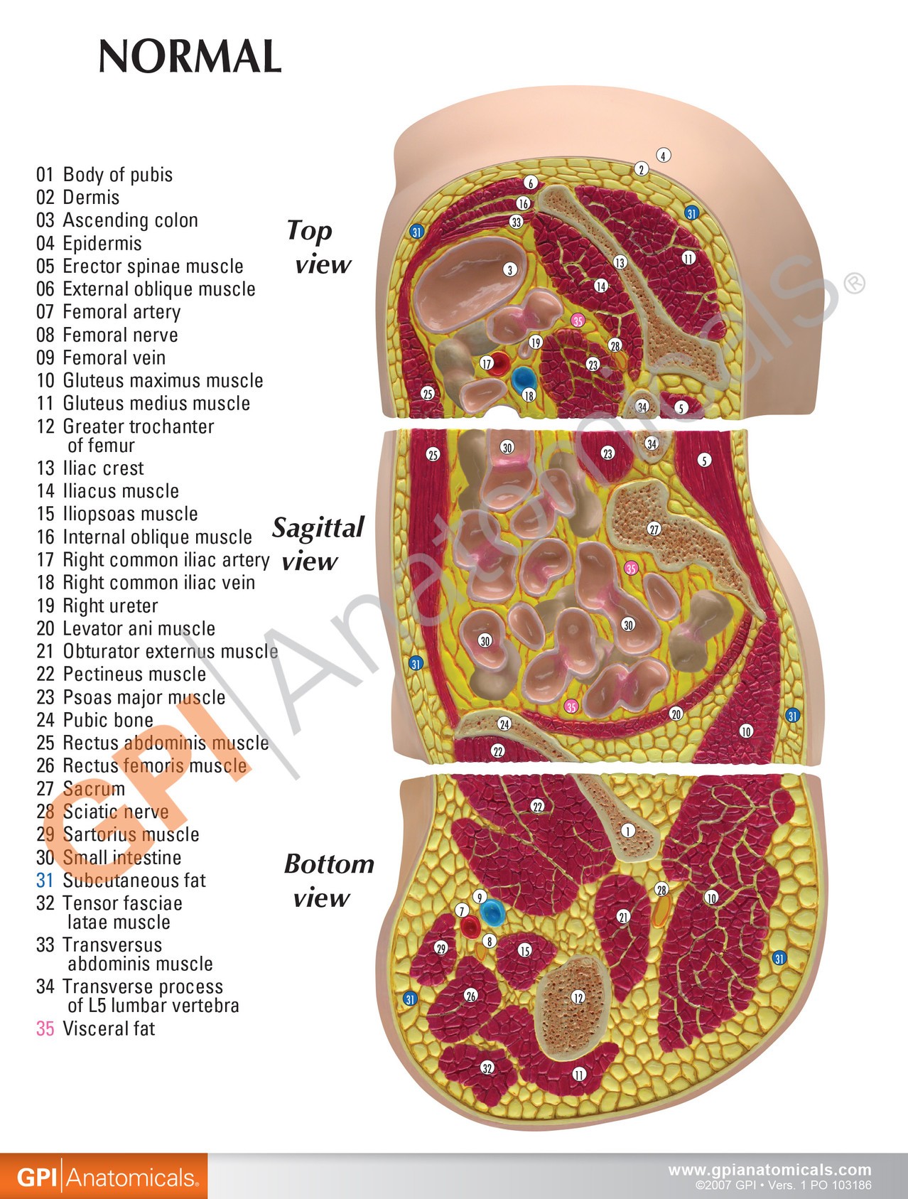 Obesity Anatomy Model
