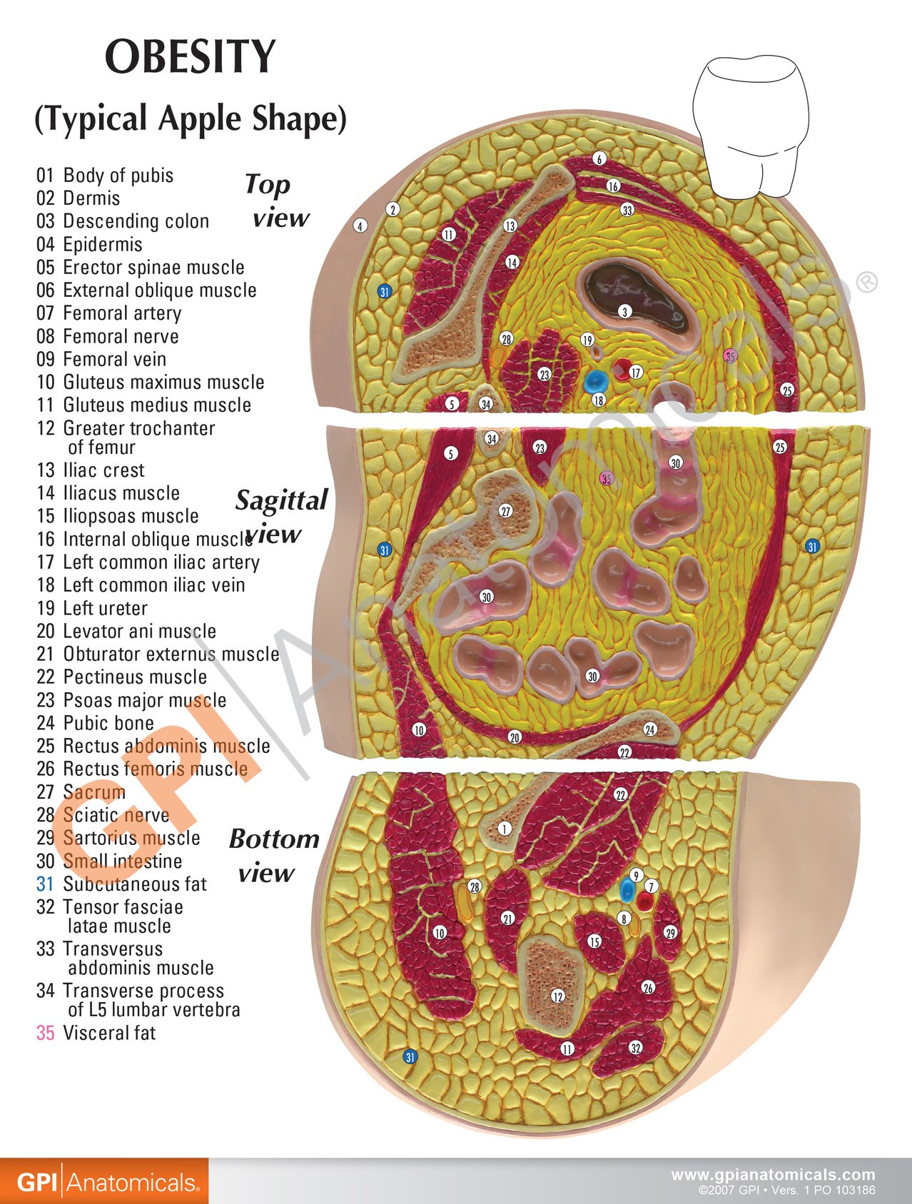 Obesity Anatomy Model
