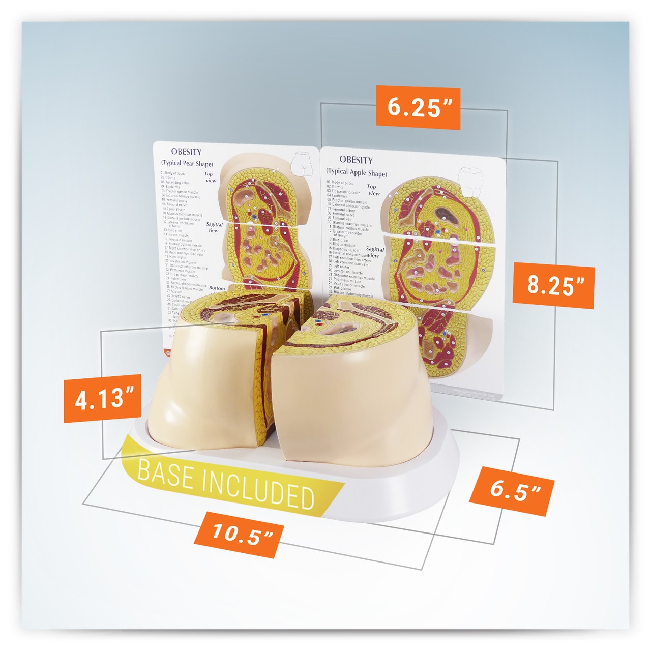 Obesity Anatomy Model
