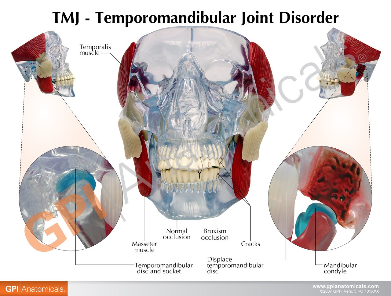 TMJ Clear Skull Anatomy Model - jaw back