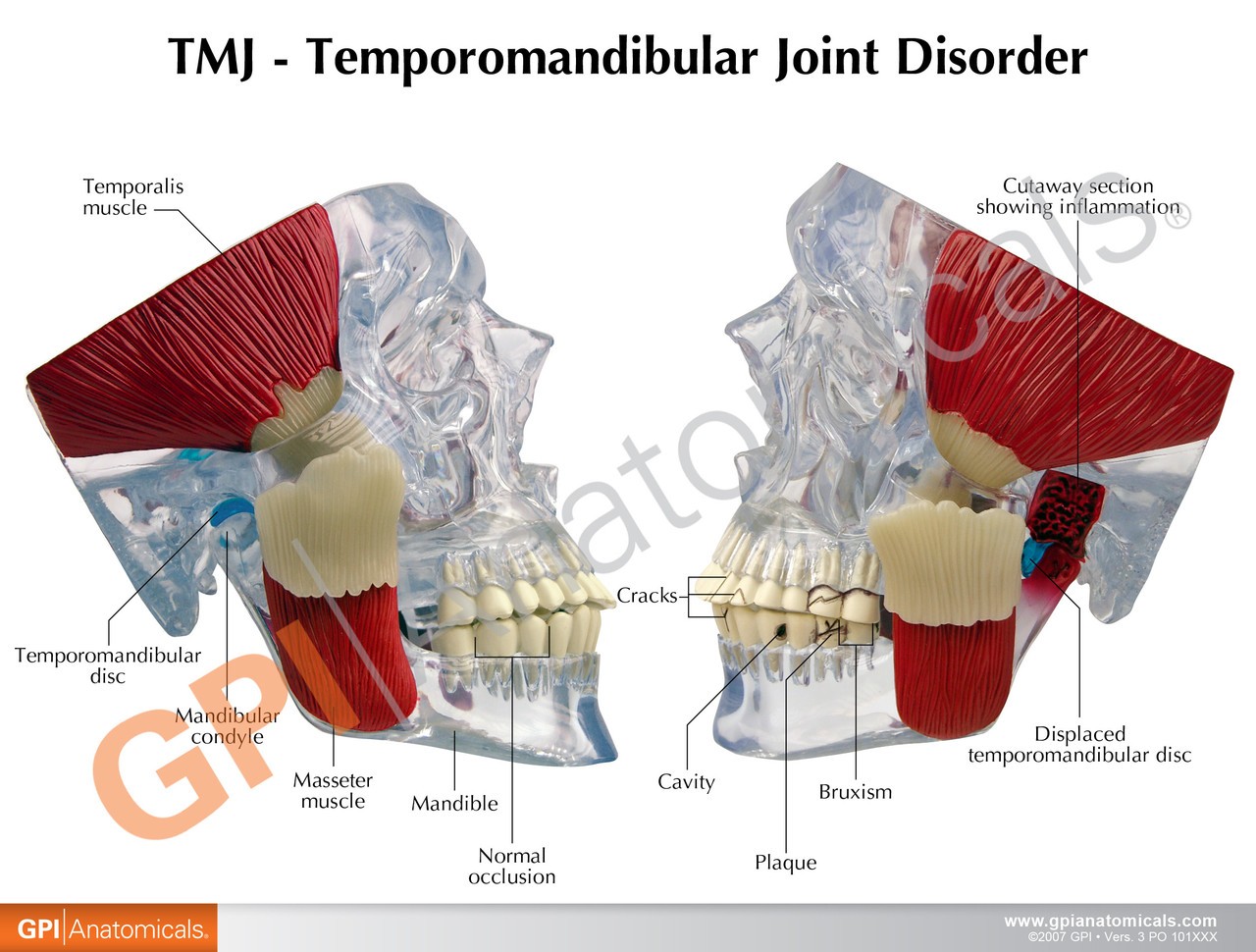 TMJ Clear Skull Anatomy Model - jaw front