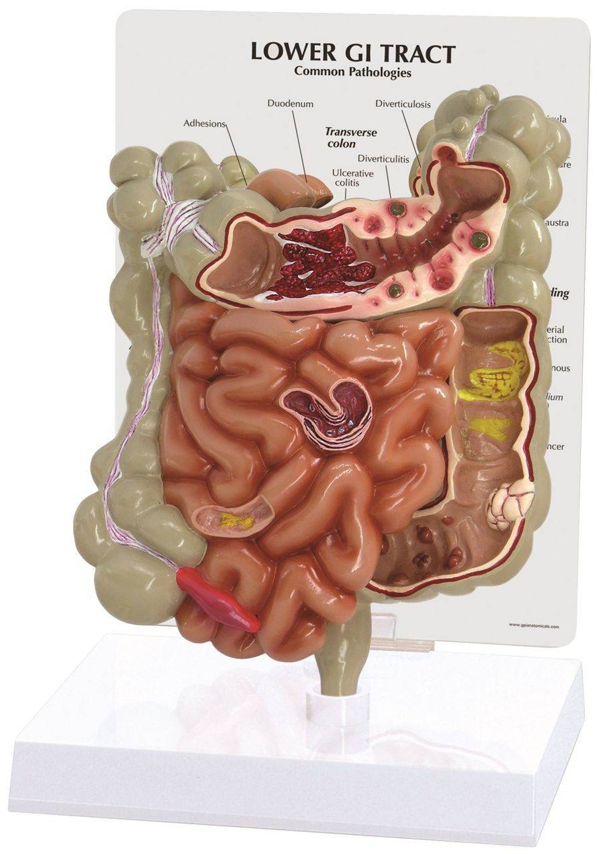 GI Tract Anatomy Model