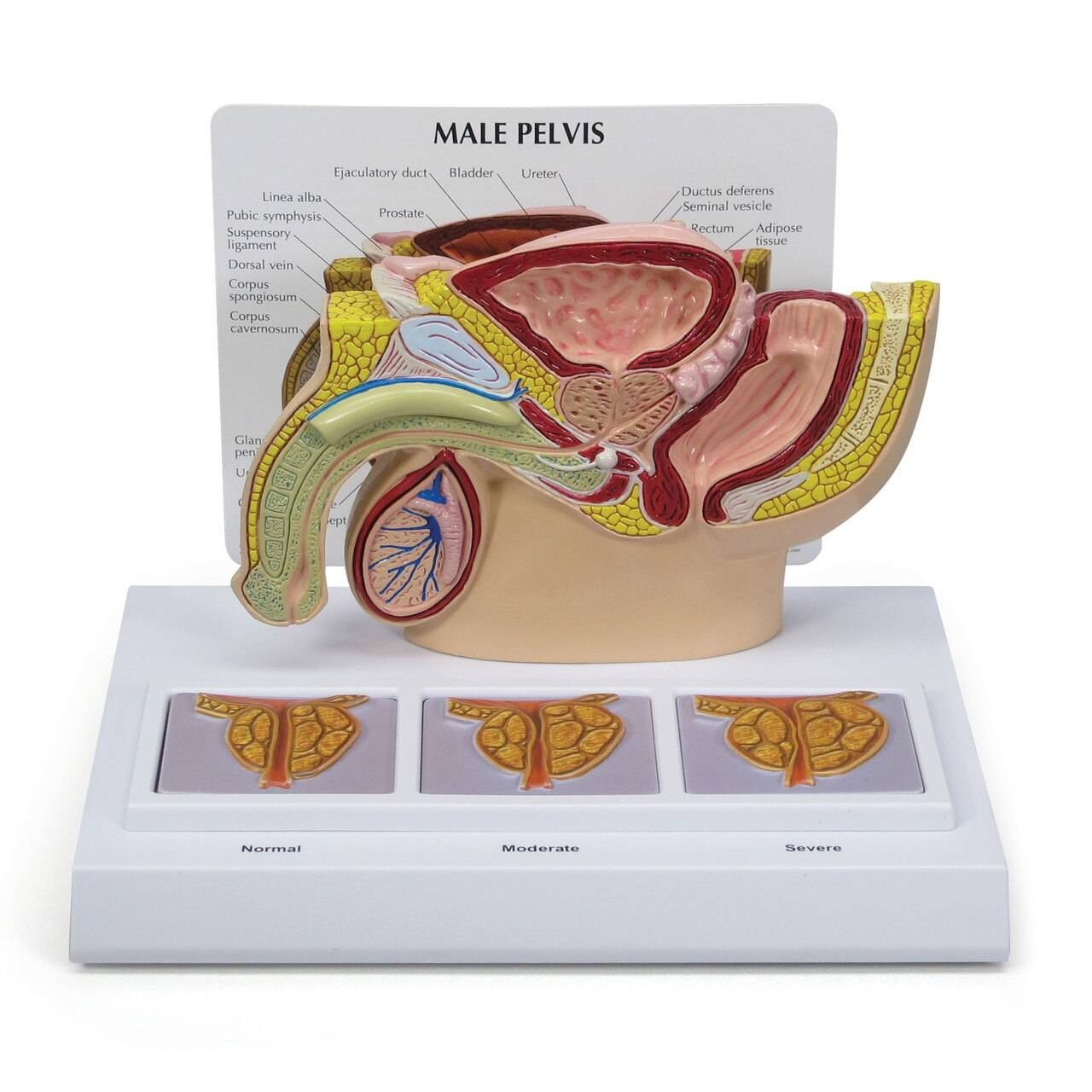 Male Pelvis Anatomy Model With Prostate Frame