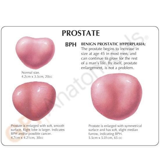Male Pelvis Anatomy Model With Prostate Frame