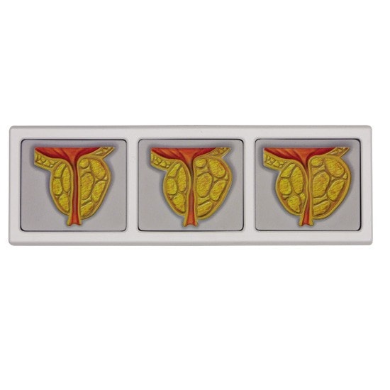 Male Pelvis Anatomy Model With Prostate Frame