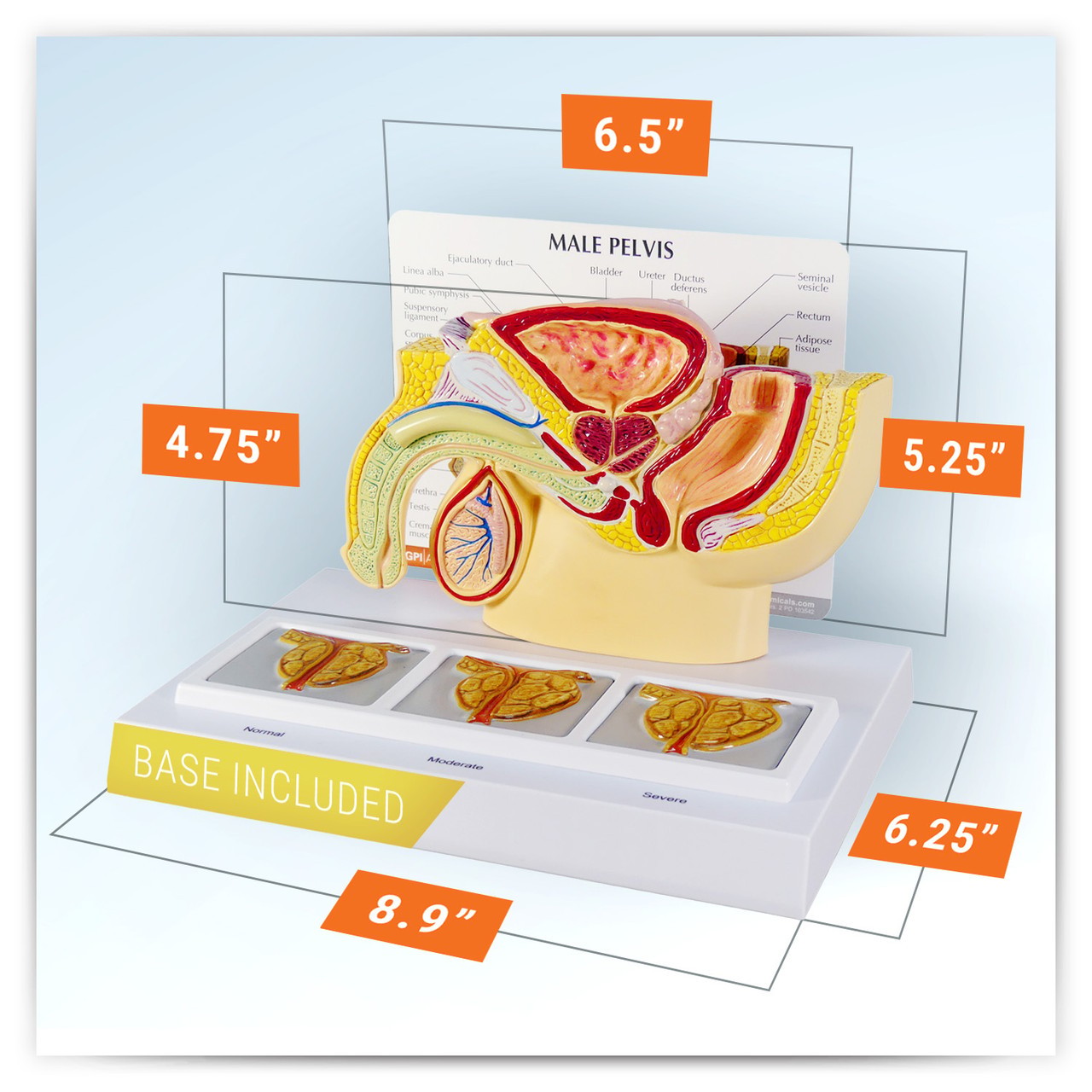 Male Pelvis Anatomy Model With Prostate Frame