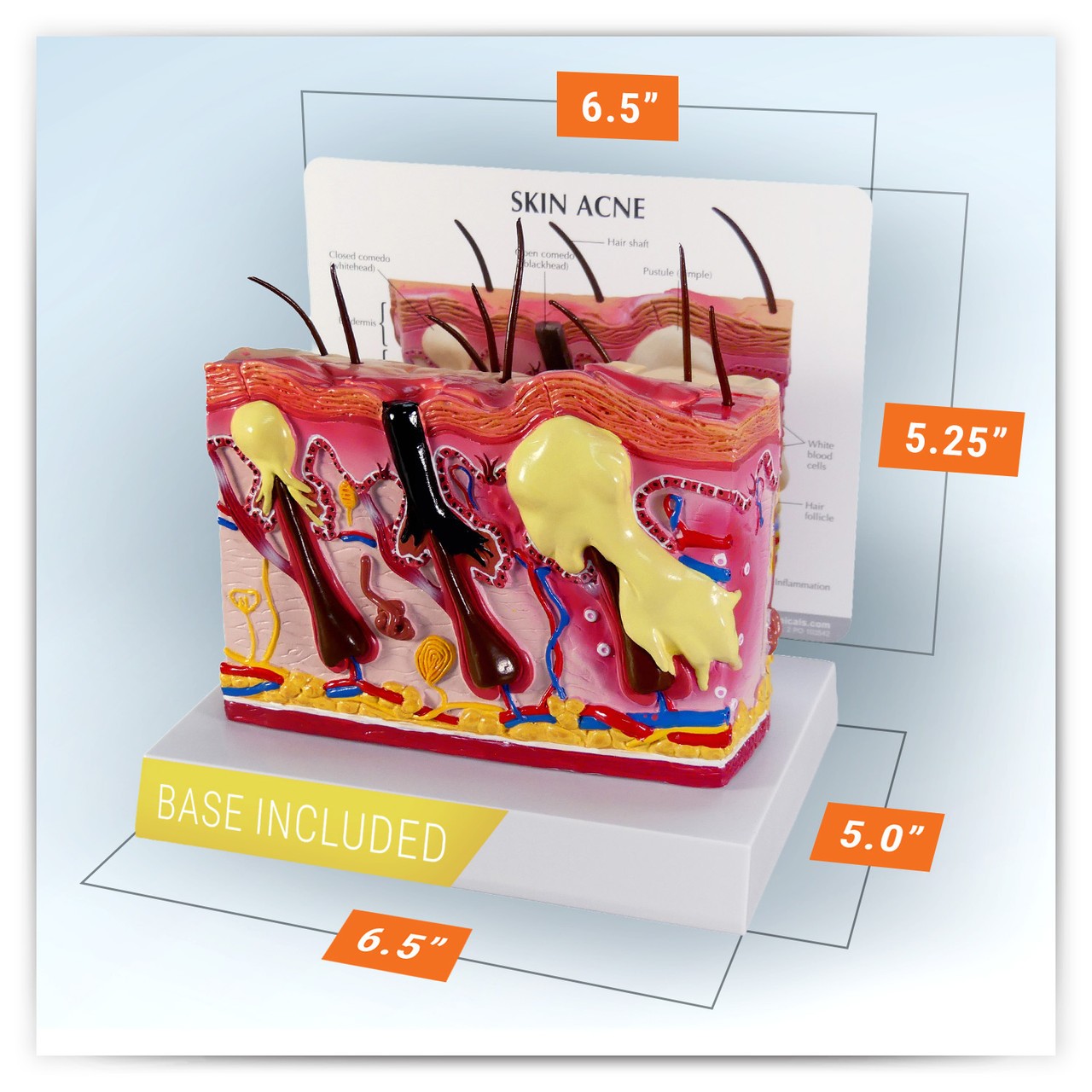 Skin Normal/Acne Anatomy Model