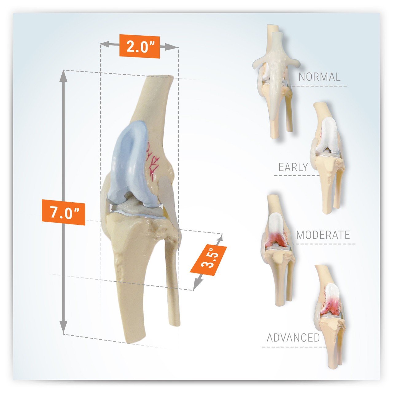 Canine 4-Stage Knee Anatomy Model