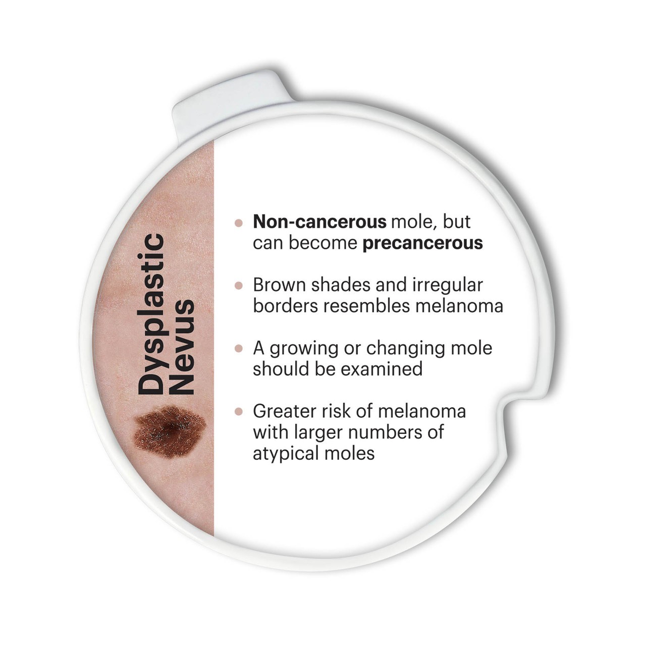 Skin Cancer Disk Set Anatomy Model