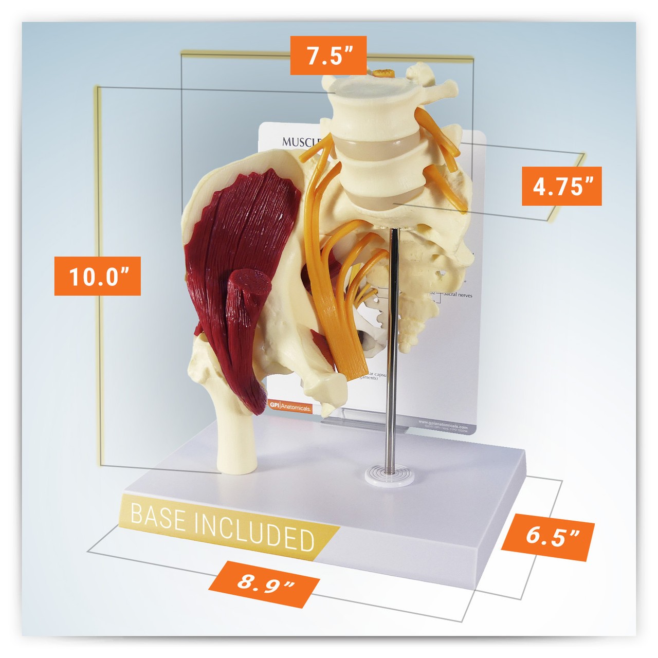 Muscled Hip with Sciatic Nerve Anatomy Model