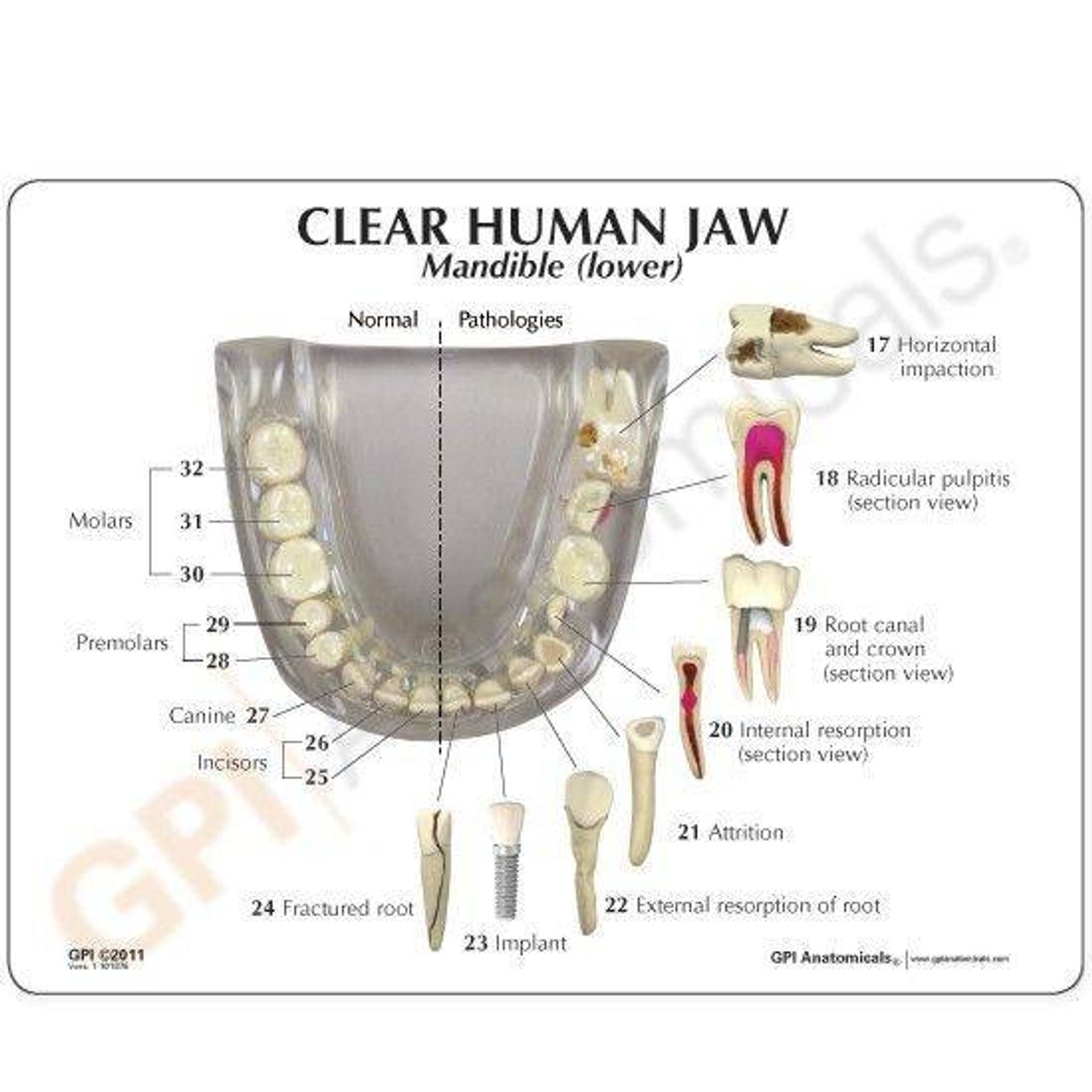 Clear Human Jaw with Teeth Anatomy Model