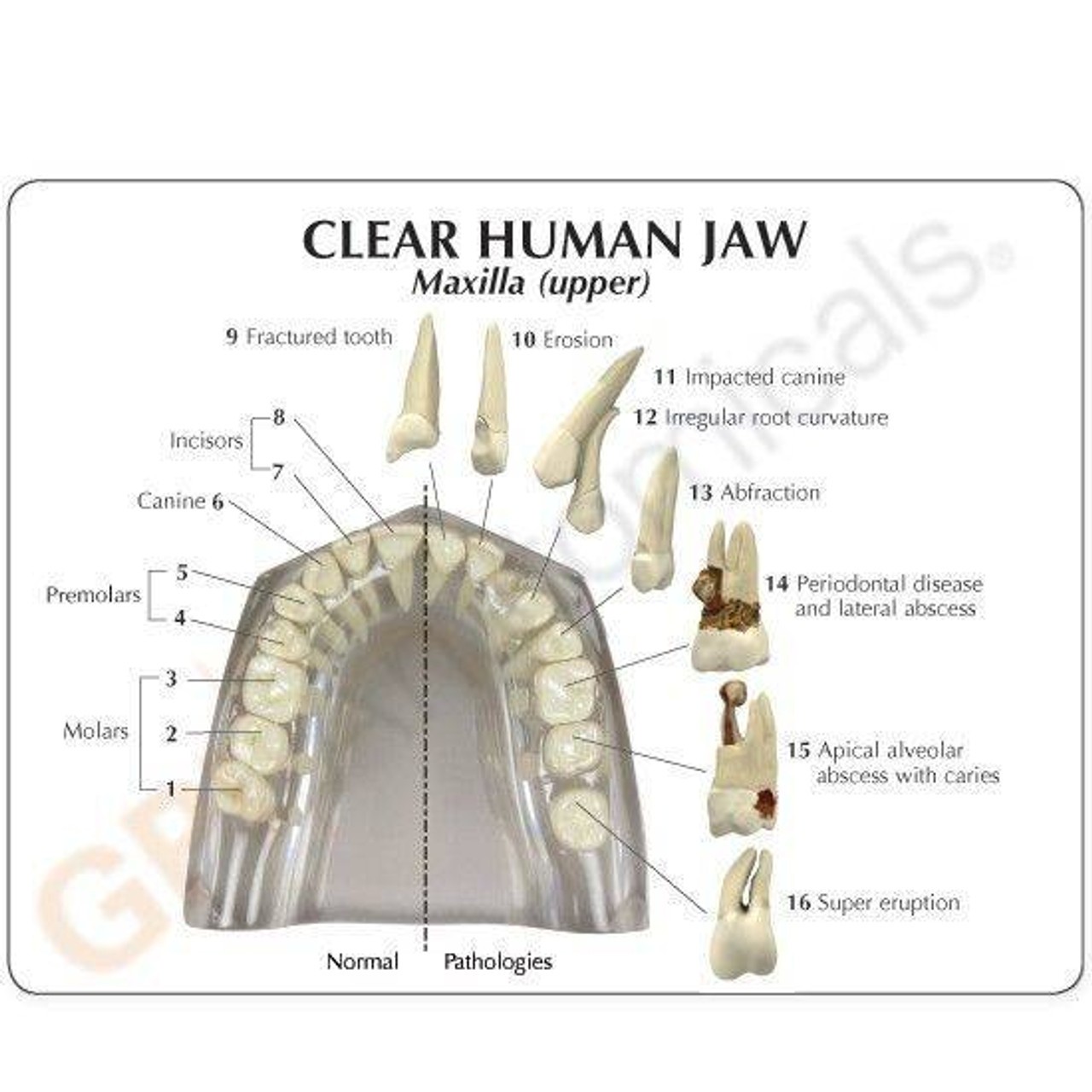 Clear Human Jaw with Teeth Anatomy Model