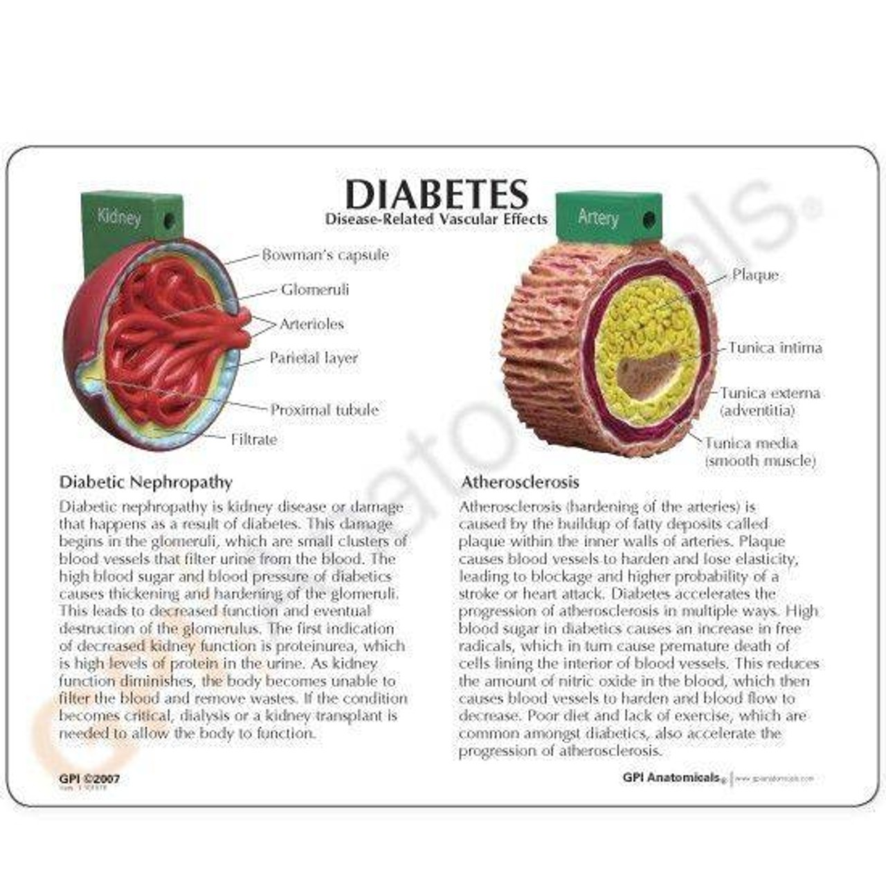 4-Piece Diabetes Anatomy Model