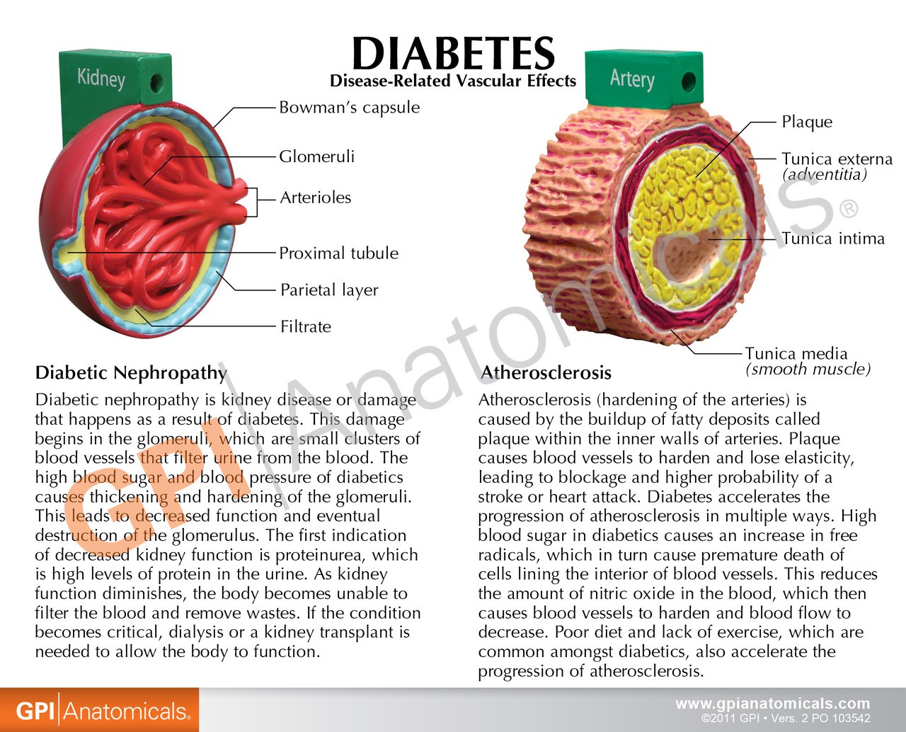 4-Piece Diabetes Anatomy Model