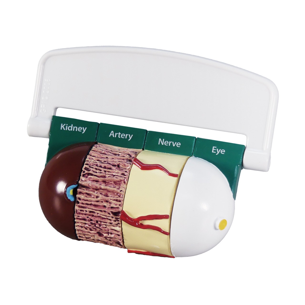 4-Piece Diabetes Anatomy Model