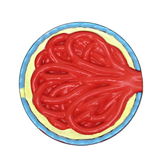 4-Piece Diabetes Anatomy Model