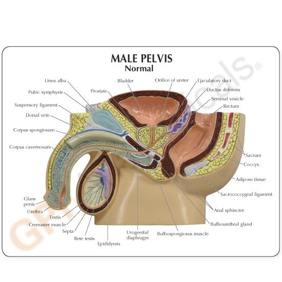 Male Pelvis with Benign Prostatic Hyperplasia Insert