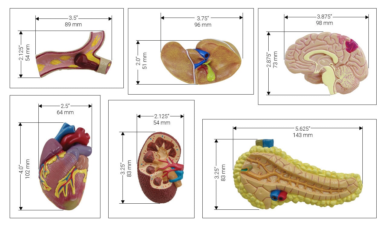 Metabolic Syndrome Anatomy Model Set