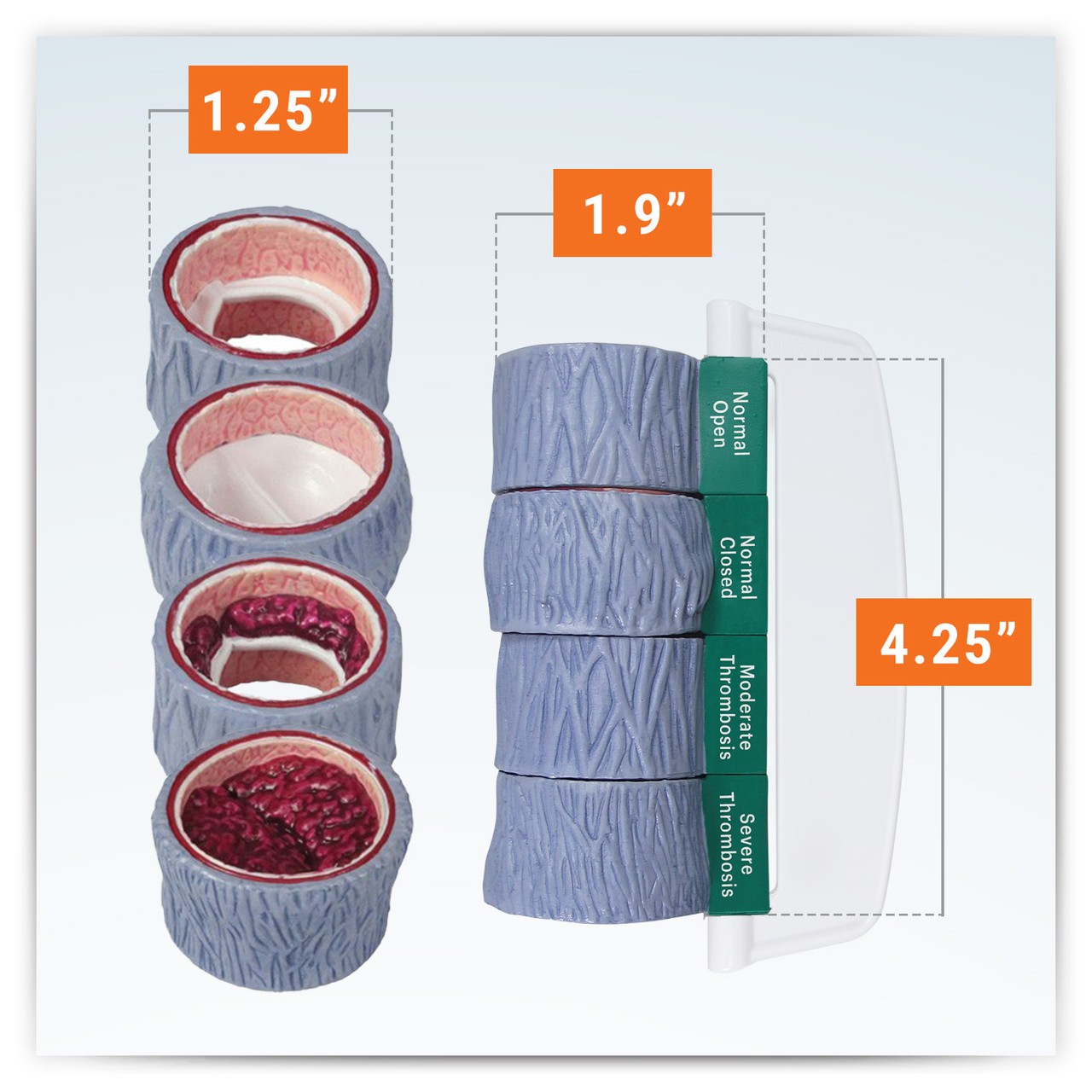 4-Piece Vein Cross Section Anatomy Model