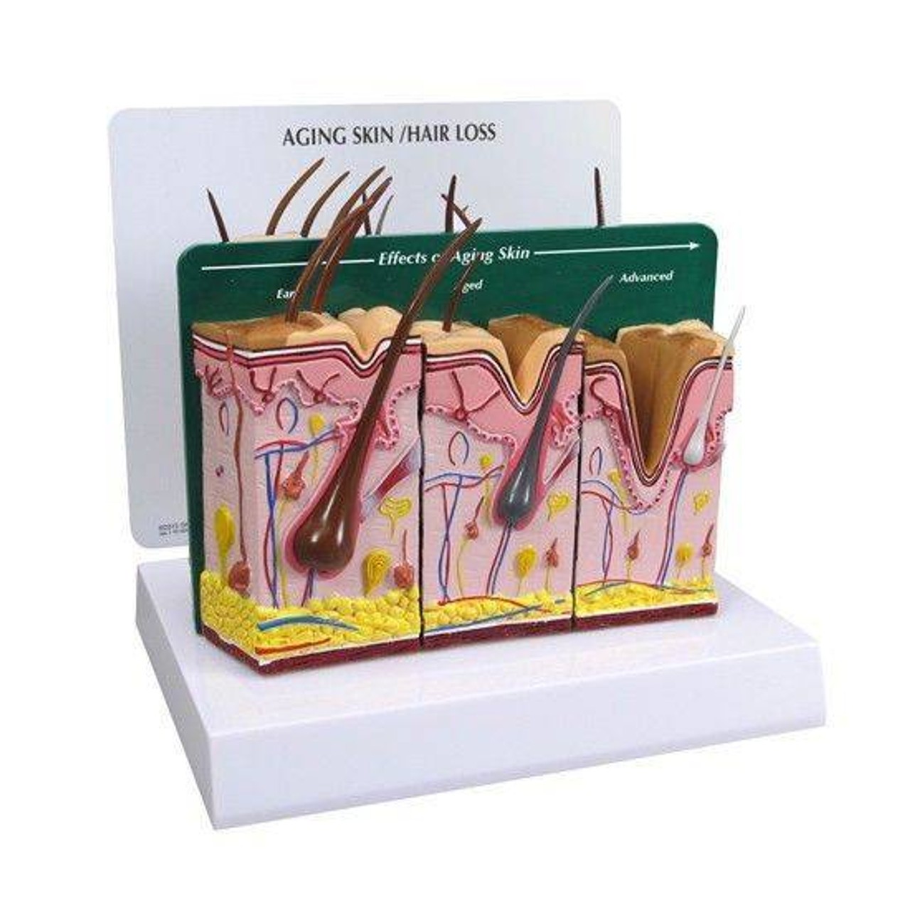 Aging Skin, Hair Loss and Normal Skin Anatomy Model