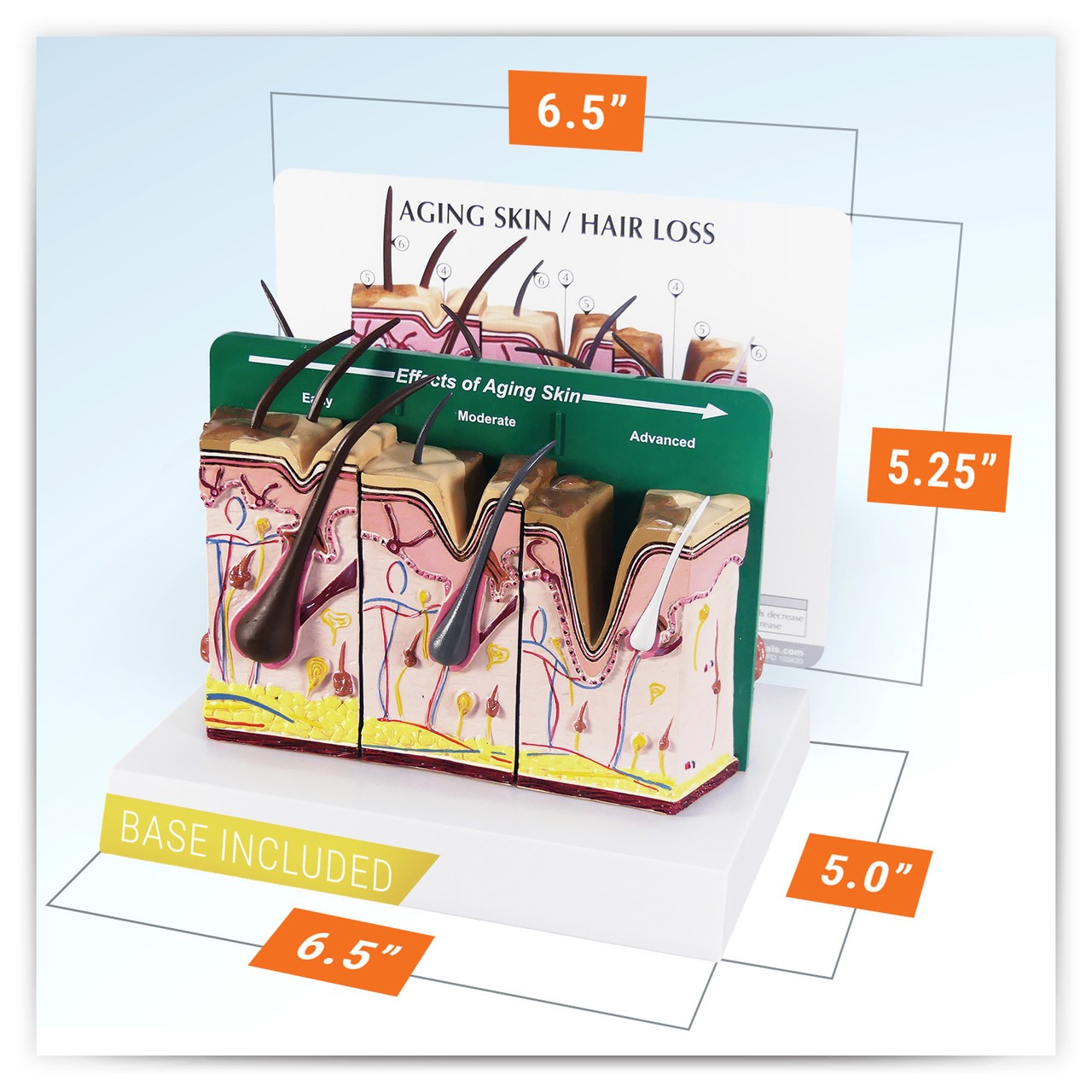 Aging Skin, Hair Loss and Normal Skin Anatomy Model