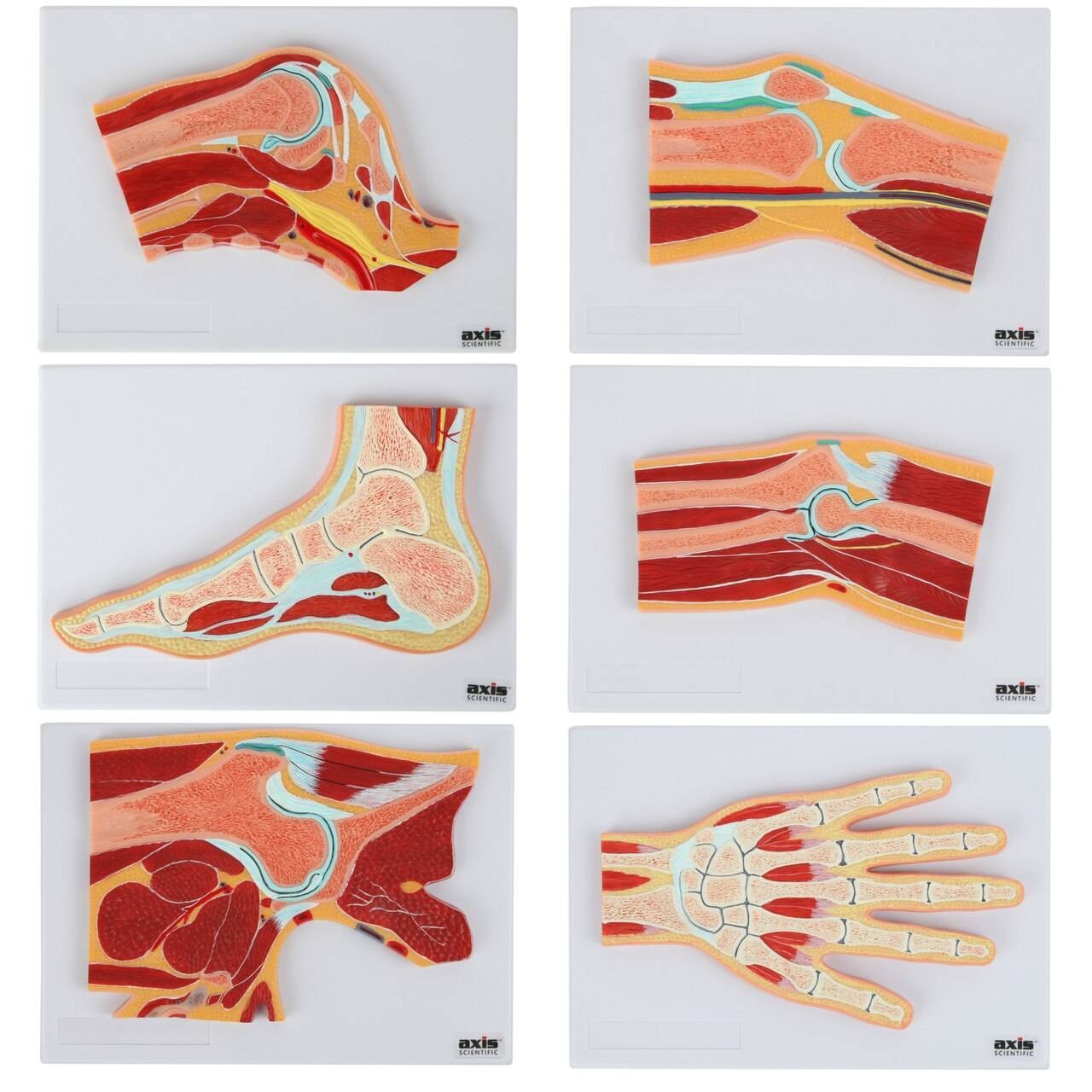 Axis Scientific Joint Cross Section Anatomy Model Set | Anatomy