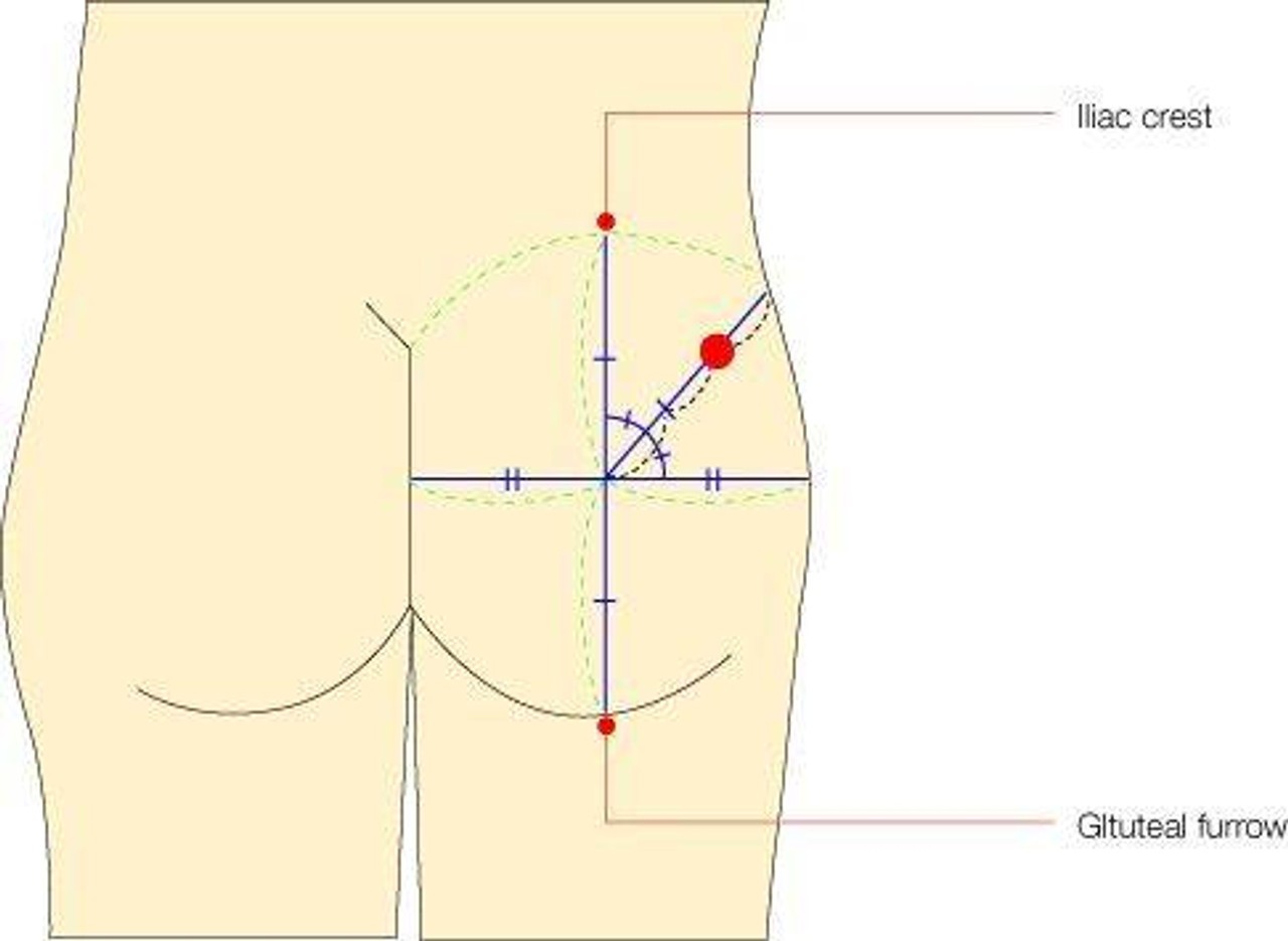 KOKEN Gluteal Intramuscular Injection Model