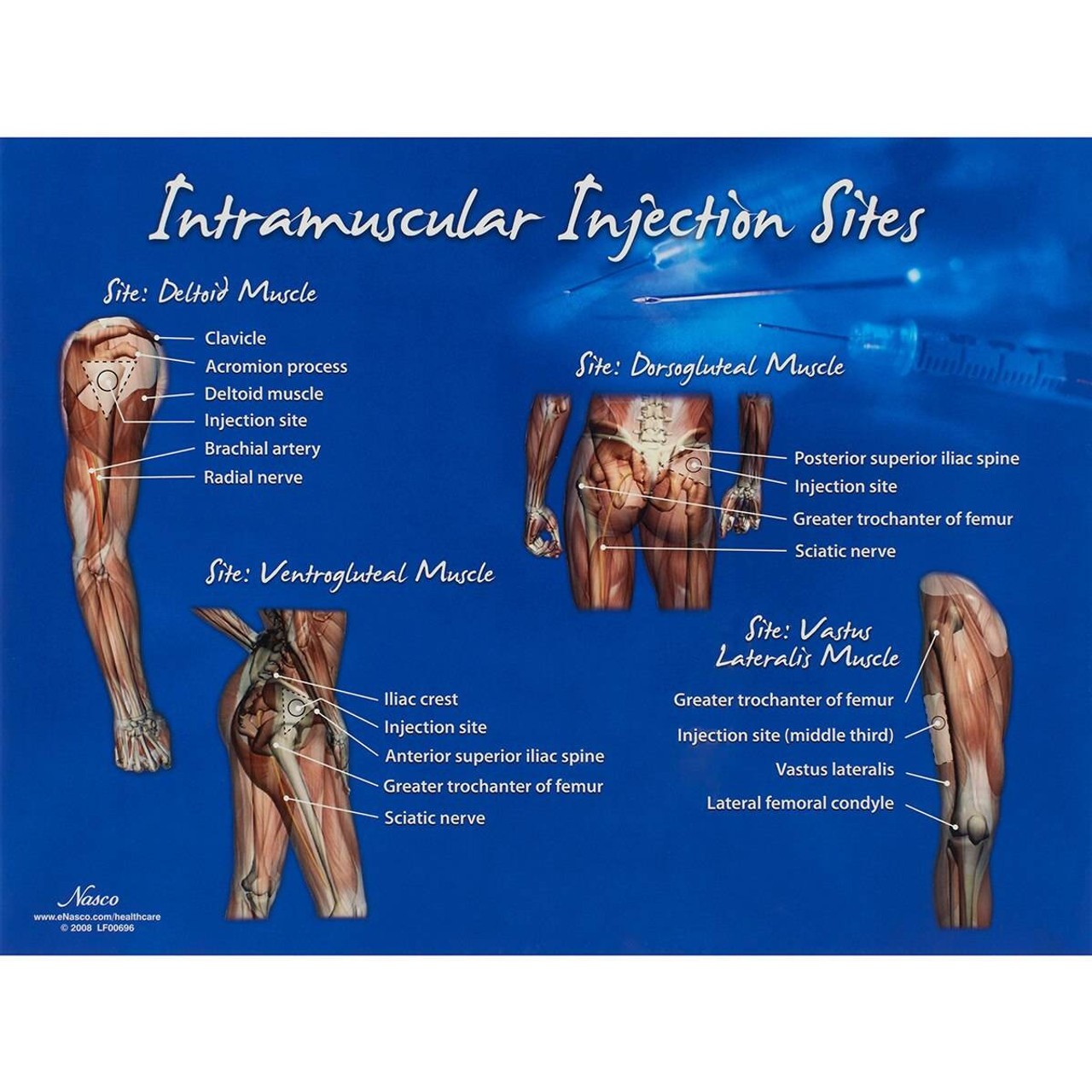 Intramuscular Injection Visual Aid Chart