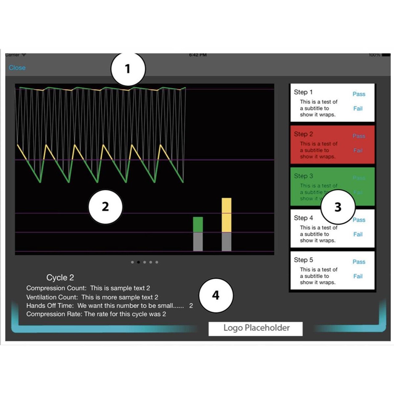 Life/form CPARLENE Full-Size Manikin with CPR Metrix and iPad - Dark