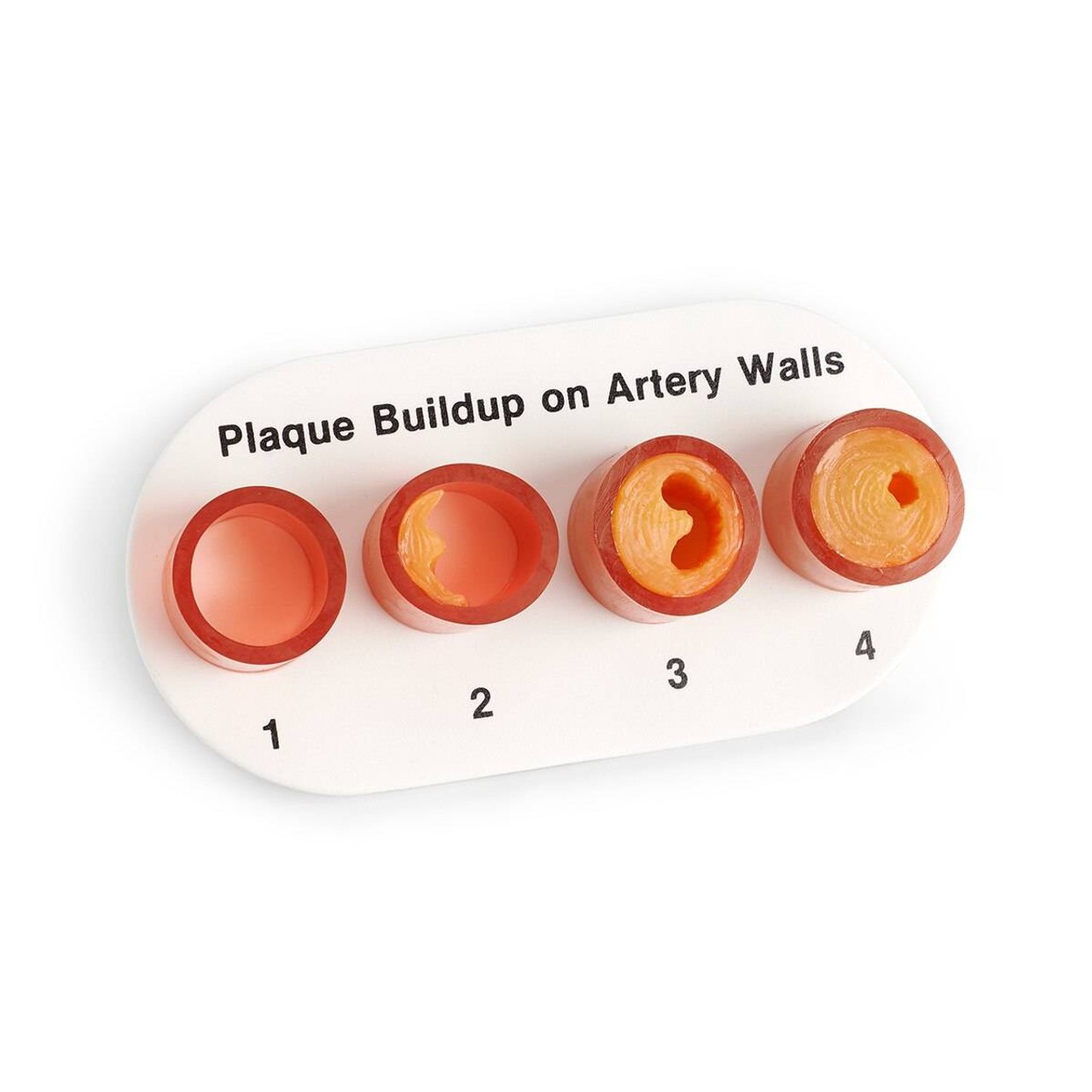 Nasco Artery Section with Blockage Model