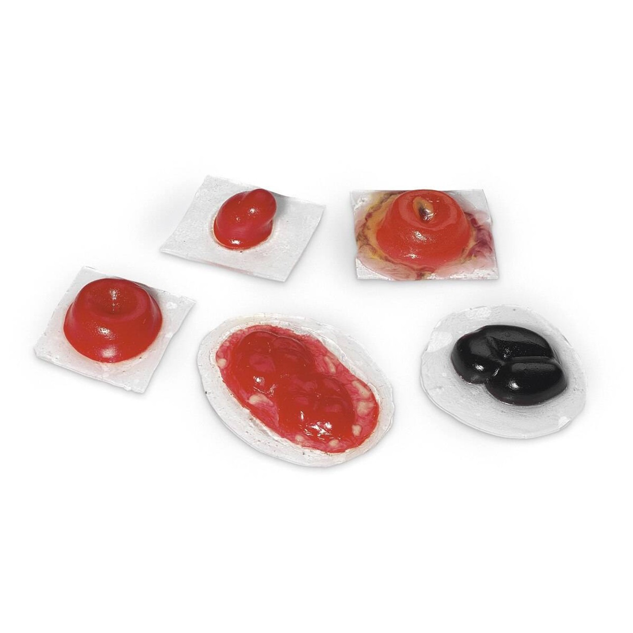 Life/form Wound - Ostomies