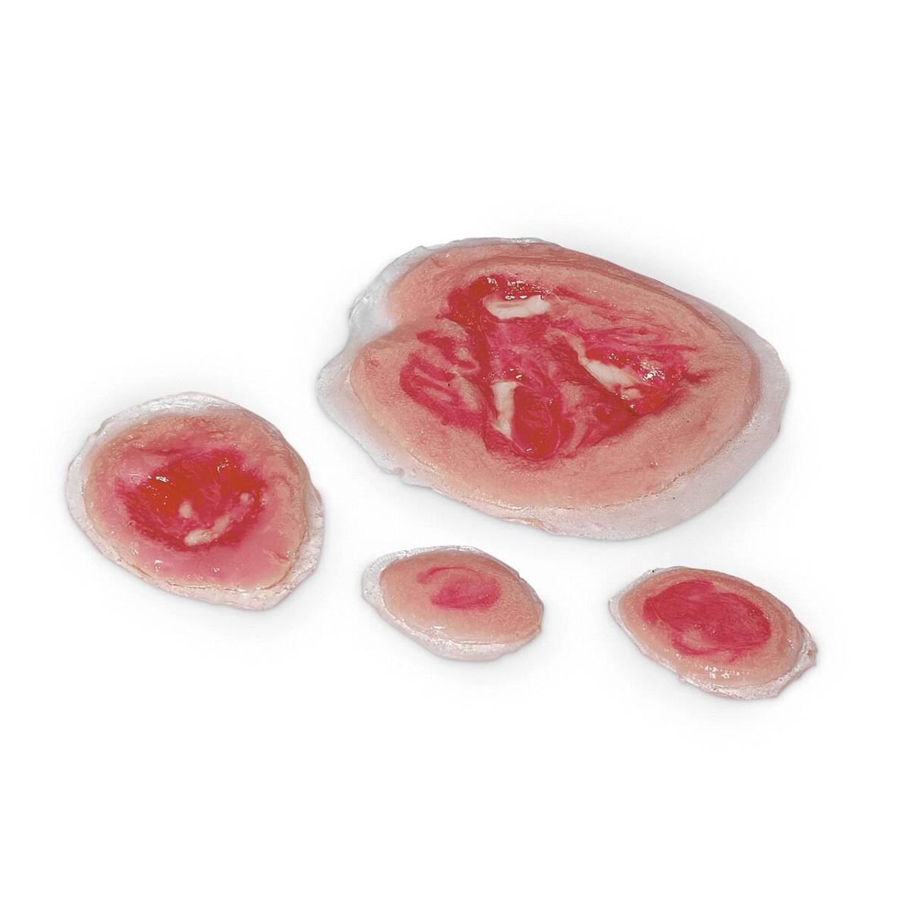 Life/form Wound - Pressure Ulcers