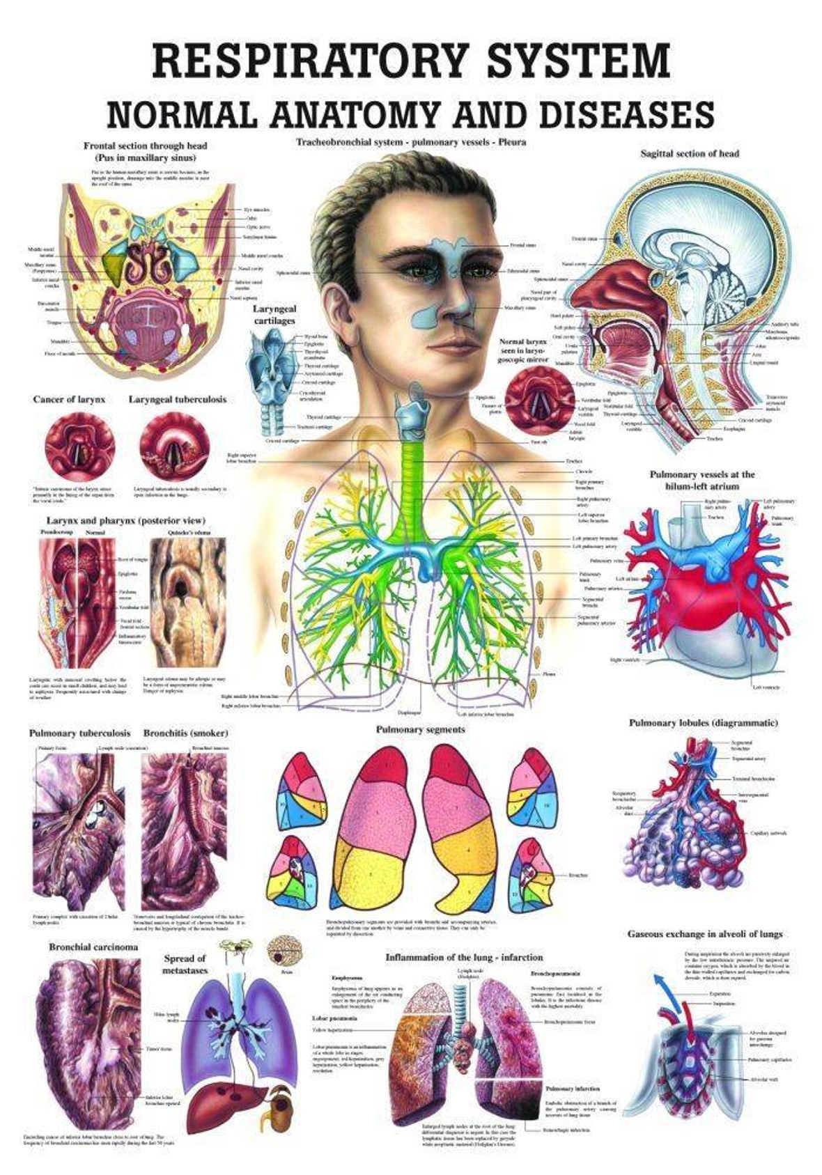 The Respiratory System - Normal and Diseased Laminated Anatomy Chart