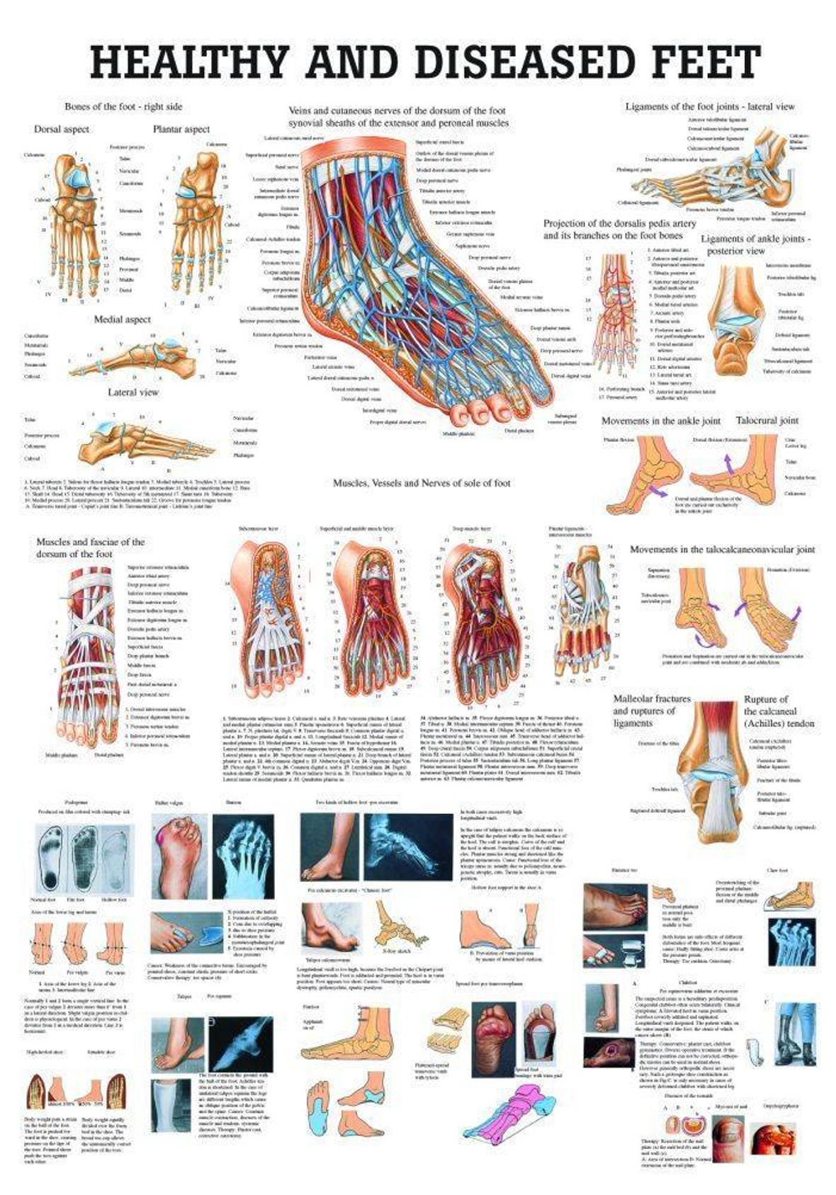 Healthy and Diseased Foot Laminated Anatomy Chart