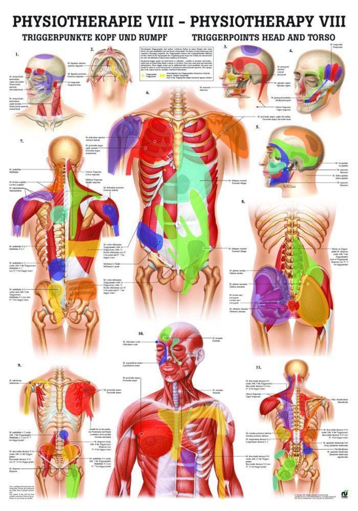 Trigger Points Head and Torso Laminated Chart